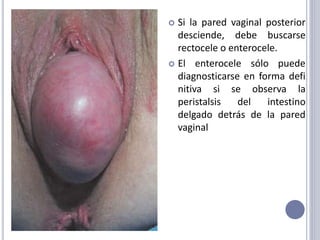  Si la pared vaginal posterior
desciende, debe buscarse
rectocele o enterocele.
 El enterocele sólo puede
diagnosticarse en forma defi
nitiva si se observa la
peristalsis del intestino
delgado detrás de la pared
vaginal
 