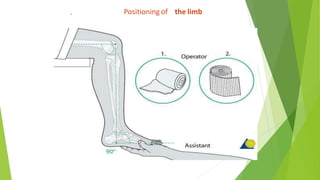 . Positioning of the limb
 