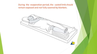 During the evaporation period, the casted limb should
remain exposed and not fully covered by blankets.
 