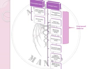 Спонтанний 
гемостаз 
 