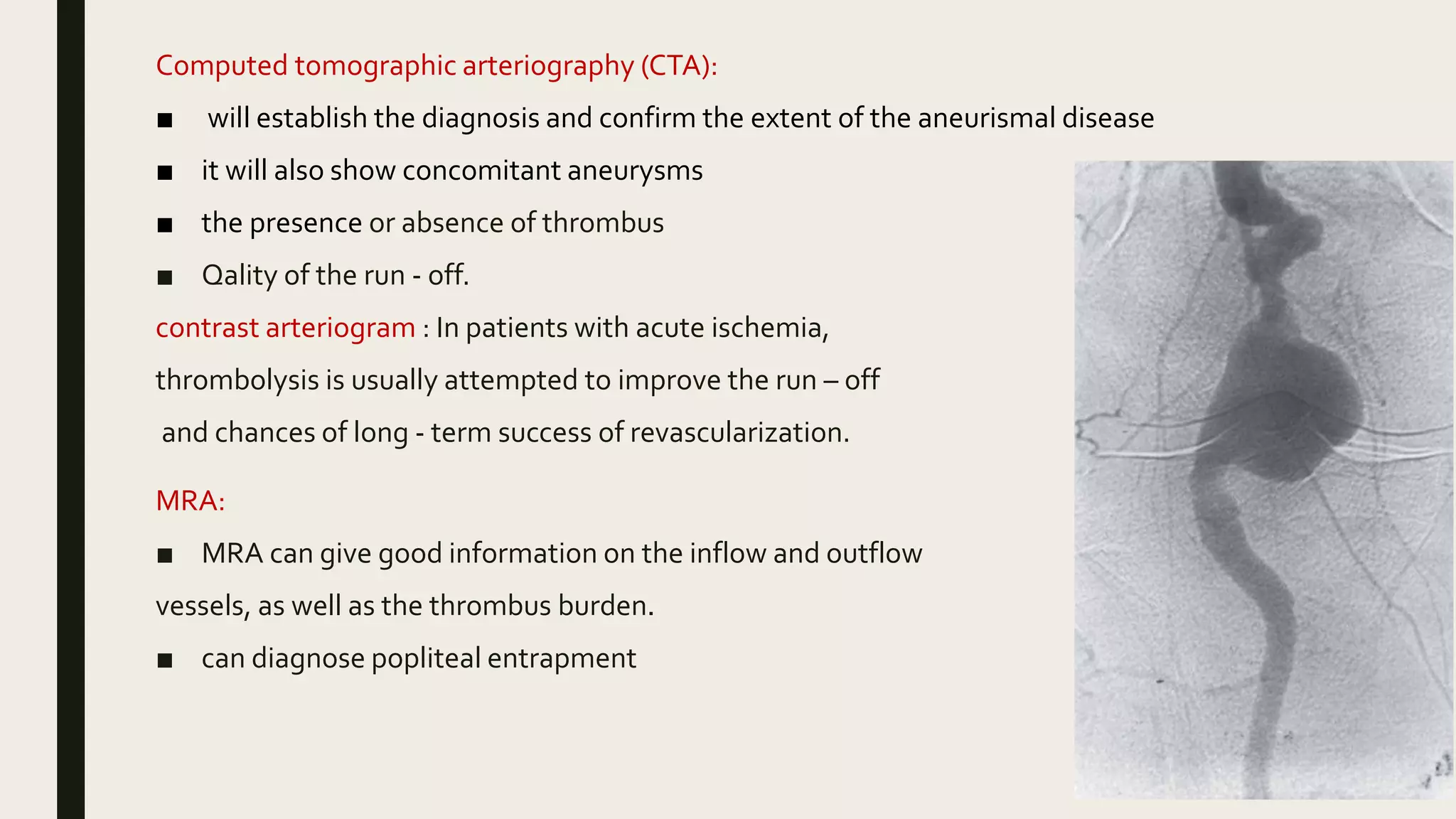 Popliteal artery aneurysm | PPTX