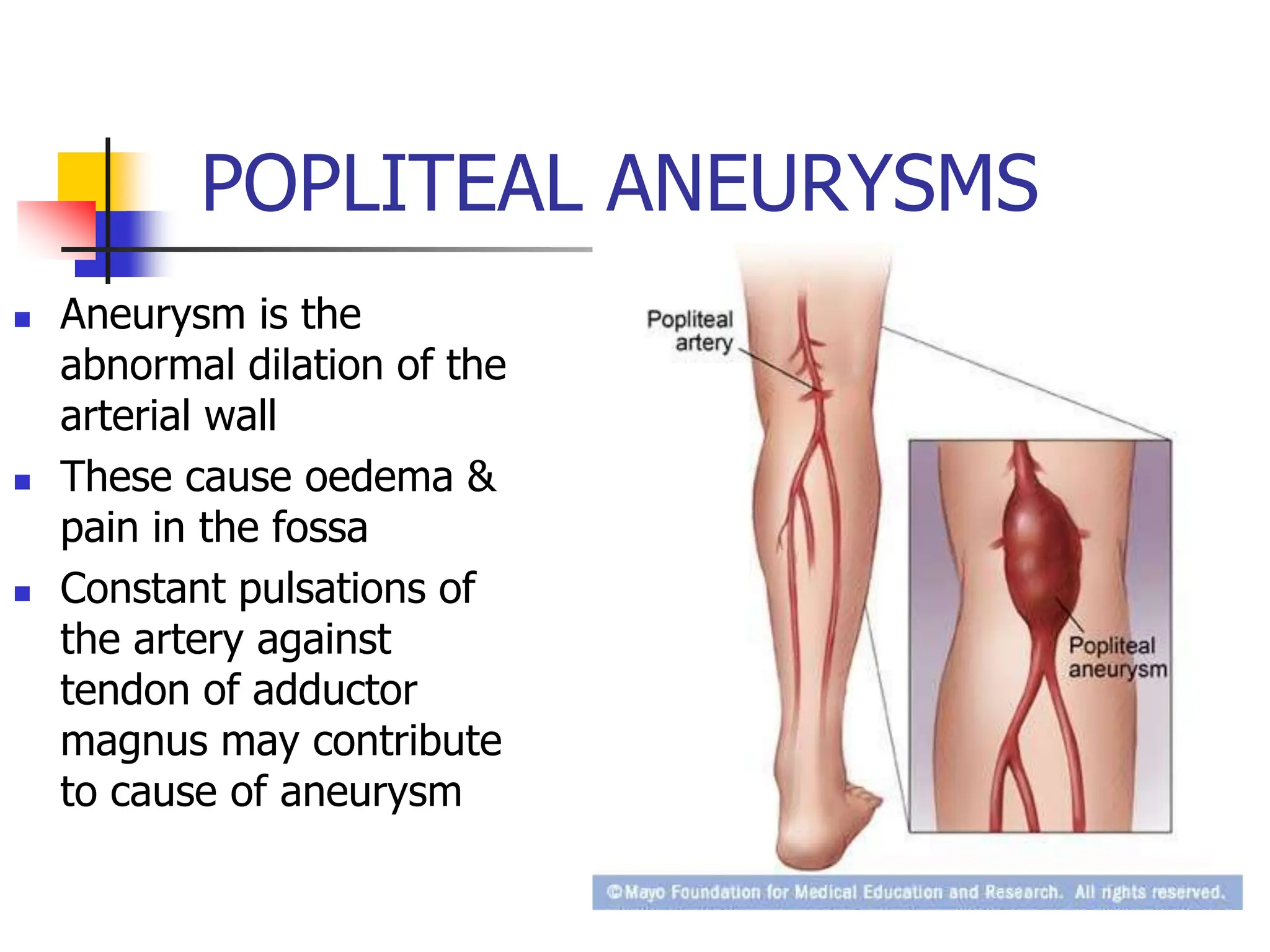POPLITEAL ANEURYSMS
 Aneurysm is the
abnormal dilation of the
arterial wall
 These cause oedema &
pain in the fossa
 Constant pulsations of
the artery against
tendon of adductor
magnus may contribute
to cause of aneurysm
 