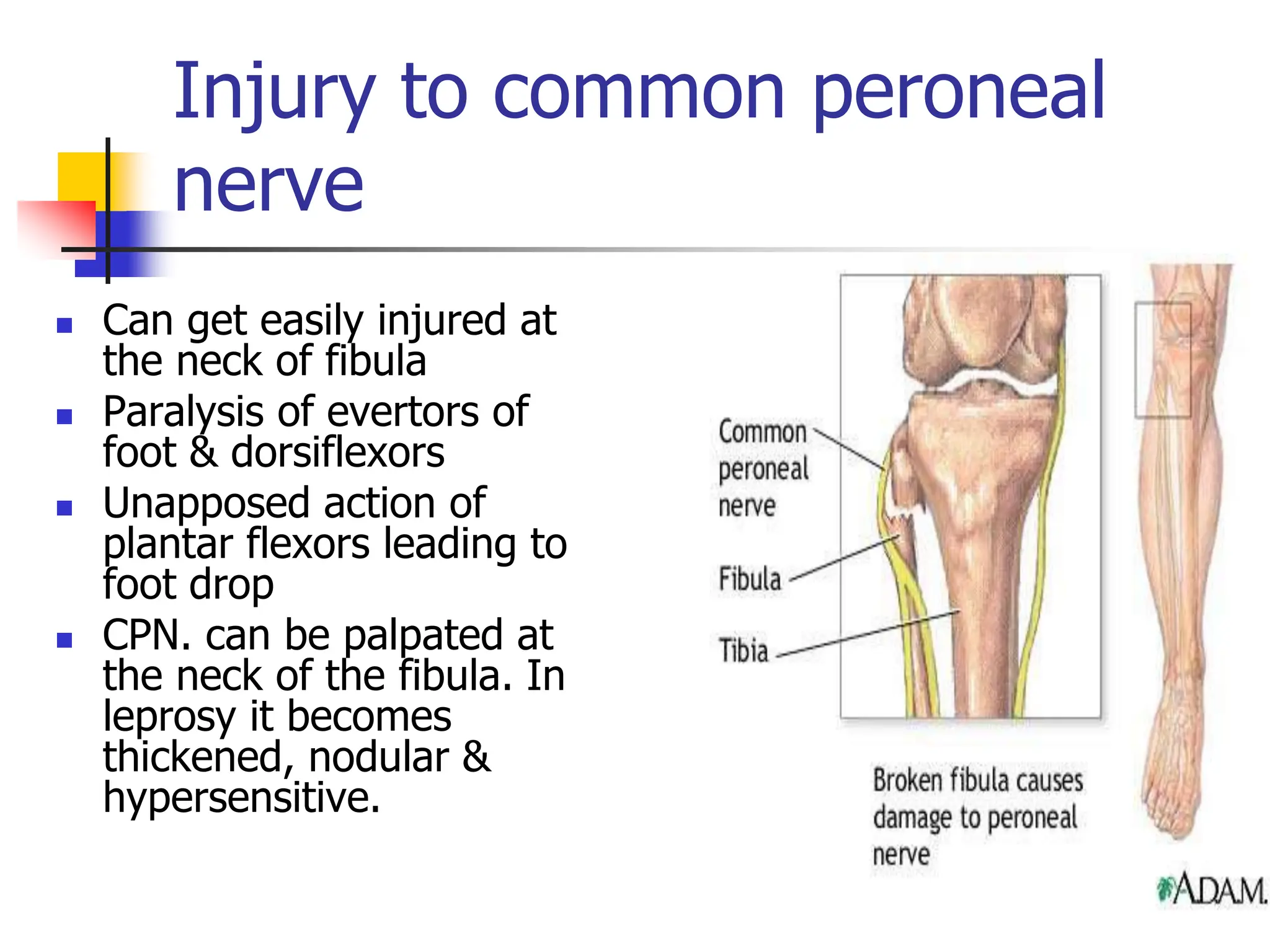 Injury to common peroneal
nerve
 Can get easily injured at
the neck of fibula
 Paralysis of evertors of
foot & dorsiflexors
 Unapposed action of
plantar flexors leading to
foot drop
 CPN. can be palpated at
the neck of the fibula. In
leprosy it becomes
thickened, nodular &
hypersensitive.
 