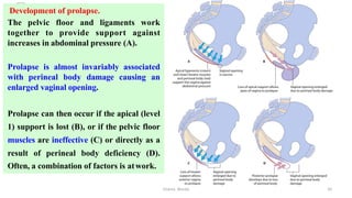  
Development of prolapse.
The pelvic floor and ligaments work
together to provide support against
increases in abdominal pressure (A).
Prolapse is almost invariably associated
with perineal body damage causing an
enlarged vaginal opening.
Prolapse can then occur if the apical (level
1) support is lost (B), or if the pelvic floor
muscles are ineffective (C) or directly as a
result of perineal body deficiency (D).
Often, a combination of factors is atwork.
Osama	
  	
  Warda	
   10	
  
 