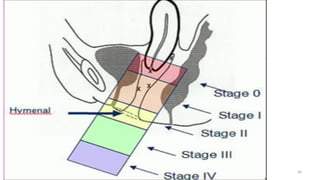  
Osama	
  	
  Warda	
   30	
  
 