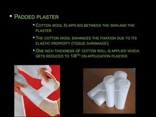 • PADDED PLASTER
• COTTON WOOL IS APPLIED BETWEEN THE SKIN AND THE
PLASTER
• THE COTTON WOOL ENHANCES THE FIXATION DUE TO ITS
ELASTIC PROPERTY (TISSUE SHRINKAGE)
• ONE INCH THICKNESS OF COTTON ROLL IS APPLIED WHICH
GETS REDUCED TO 1/8TH ON APPLICATION PLASTER
 