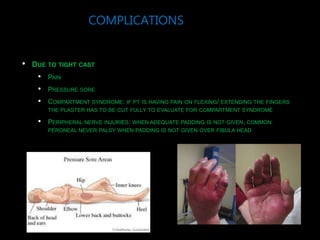 COMPLICATIONS
• DUE TO TIGHT CAST
• PAIN
• PRESSURE SORE
• COMPARTMENT SYNDROME: IF PT IS HAVING PAIN ON FLEXING/ EXTENDING THE FINGERS
THE PLASTER HAS TO BE CUT FULLY TO EVALUATE FOR COMPARTMENT SYNDROME
• PERIPHERAL NERVE INJURIES: WHEN ADEQUATE PADDING IS NOT GIVEN, COMMON
PERONEAL NEVER PALSY WHEN PADDING IS NOT GIVEN OVER FIBULA HEAD
 