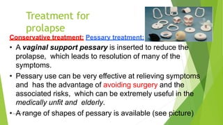 Treatment for
prolapse
Osama Warda 32
Conservative treatment: Pessary treatment:
• A vaginal support pessary is inserted to reduce the
prolapse, which leads to resolution of many of the
symptoms.
• Pessary use can be very eﬀective at relieving symptoms
and has the advantage of avoiding surgery and the
associated risks, which can be extremely useful in the
medically unﬁt and elderly.
• A range of shapes of pessary is available (see picture)
 