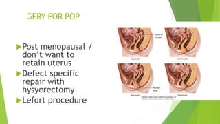 SURGERY FOR POP
Post menopausal /
don’t want to
retain uterus
Defect specific
repair with
hysyerectomy
Lefort procedure
 