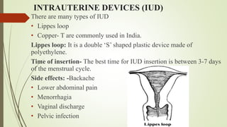 INTRAUTERINE DEVICES (IUD)
There are many types of IUD
• Lippes loop
• Copper- T are commonly used in India.
Lippes loop: It is a double ‘S’ shaped plastic device made of
polyethylene.
Time of insertion- The best time for IUD insertion is between 3-7 days
of the menstrual cycle.
Side effects: -Backache
• Lower abdominal pain
• Menorrhagia
• Vaginal discharge
• Pelvic infection
 