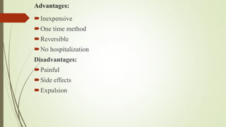 Advantages:
Inexpensive
One time method
Reversible
No hospitalization
Disadvantages:
Painful
Side effects
Expulsion
 