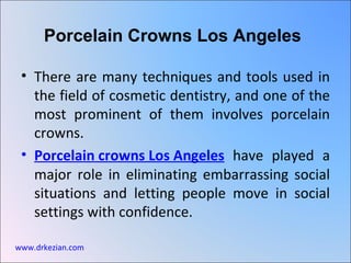 [object Object],[object Object],Porcelain Crowns Los Angeles www.drkezian.com 