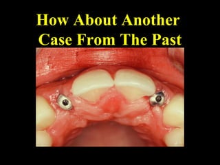 How About Another
Case From The Past