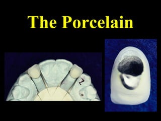 The Porcelain