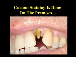 Custom Staining Is Done
On The Premises…