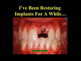 I’ve Been Restoring
Implants For A While…