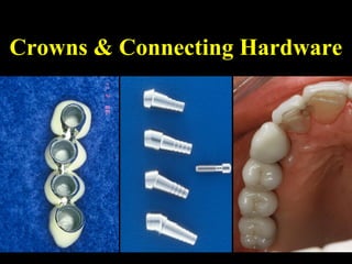 Crowns & Connecting Hardware