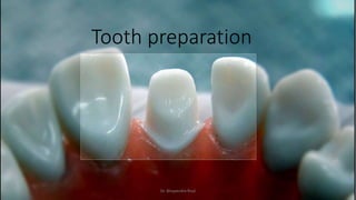 Tooth preparation
Dr. Bhupendra Rizal
 