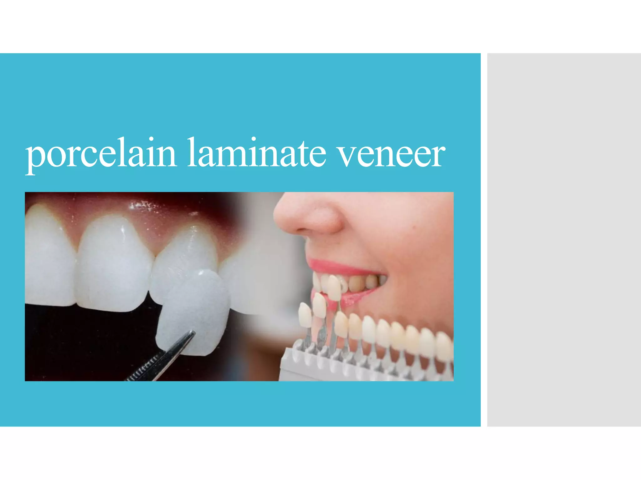 Porcelain laminate veneers (Dentistry) | PPTX