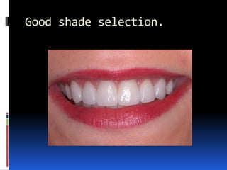 Good shade selection.
 