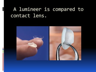 A lumineer is compared to
contact lens.
 