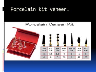 Porcelain kit veneer.
 