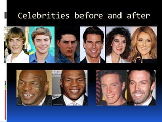 Celebrities before and after
 
