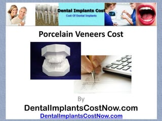 Porcelain Veneers Cost




              By
DentalImplantsCostNow.com
   DentalImplantsCostNow.com
 
