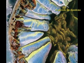 A parede do duodeno 
