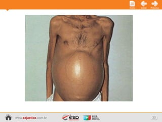 Início   Voltar   Próximo




www.sejaetico.com.br                      30
 