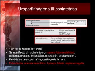Uroporfirinógeno III cosintetasa




• 150 casos reportados. (rara)
• Se manifiesta al nacimiento con severa fotosensibili...