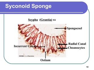 Syconoid Sponge Spongocoel Ostium Choanocytes Radial Canal Incurrent Canal Scypha   ( Grantia)  xs 