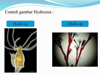 Contoh gambar Hydrozoa :
Hydra sp Obelia sp
 