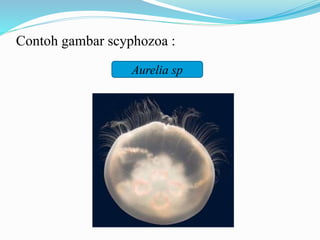 Contoh gambar scyphozoa :
Aurelia sp
 