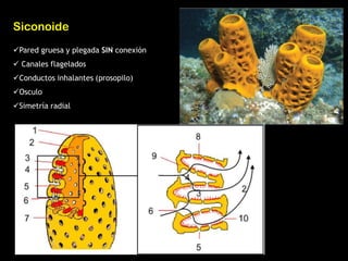 Siconoide
Pared gruesa y plegada SIN conexión
 Canales flagelados
Conductos inhalantes (prosopilo)
Osculo
Simetría radial
 