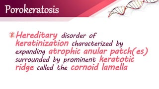 Porokeratosis
Hereditary disorder of
keratinization characterized by
expanding atrophic anular patch(es)
surrounded by prominent keratotic
ridge called the cornoid lamella
 