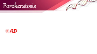 Porokeratosis
AD
 