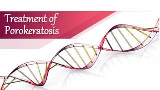 Treatment of
Porokeratosis
 