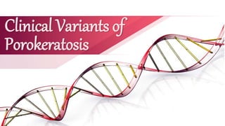Clinical Variants of
Porokeratosis
 