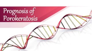 Prognosis of
Porokeratosis
 