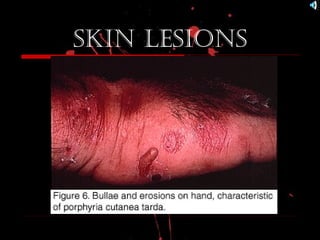 skin Lesions
 