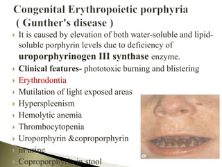  It is caused by elevation of both water-soluble and lipid-
soluble porphyrin levels due to deficiency of
uroporphyrinogen III synthase enzyme.
 Clinical features- phototoxic burning and blistering
 Erythrodontia
 Mutilation of light exposed areas
 Hyperspleenism
 Hemolytic anemia
 Thrombocytopenia
 Uroporphyrin &coproporphyrin
 in urine
 Coproporphyrin in stool
 