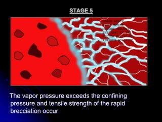 STAGE 5
The vapor pressure exceeds the confining
pressure and tensile strength of the rapid
brecciation occur
 