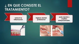 ¿ EN QUE CONSISTE EL 
TRATAMIENTO? 
reducir la 
inflamación 
higiene dental 
profesional 
seda dental o 
cepillos 
interproximales. 
