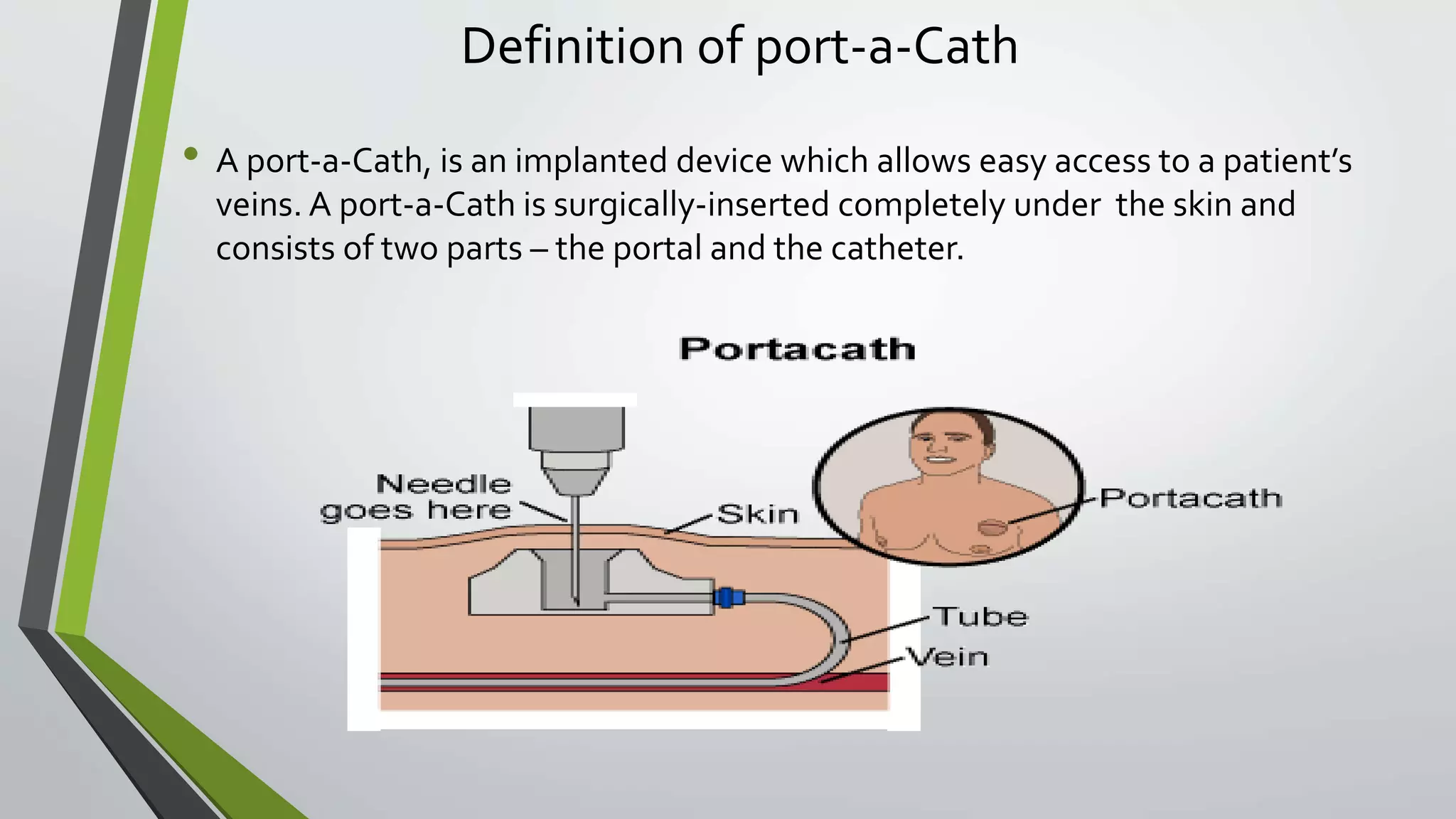 Port A cath PPTX