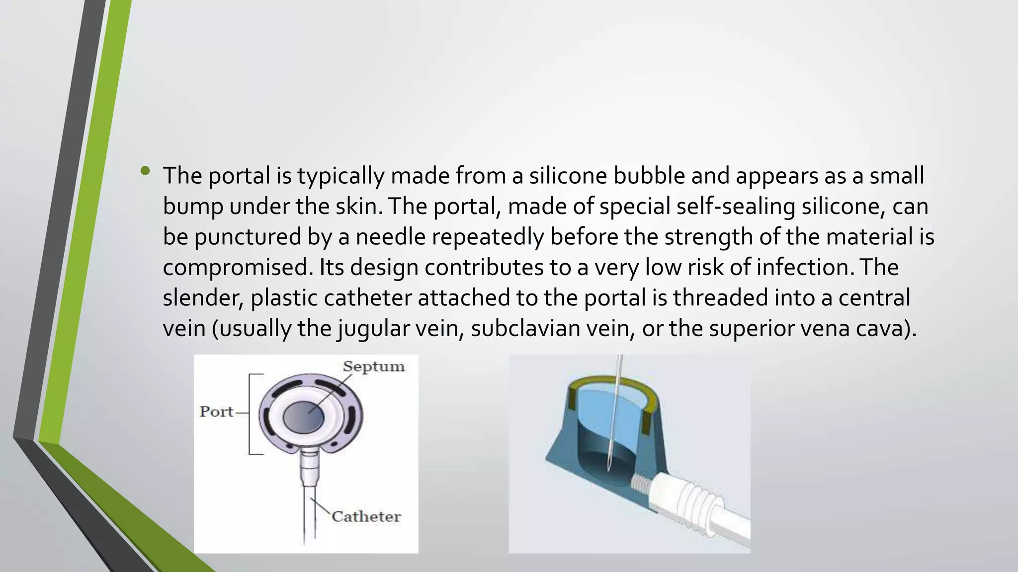 • The portal is typically made from a silicone bubble and appears as a small
bump under the skin.The portal, made of special self-sealing silicone, can
be punctured by a needle repeatedly before the strength of the material is
compromised. Its design contributes to a very low risk of infection.The
slender, plastic catheter attached to the portal is threaded into a central
vein (usually the jugular vein, subclavian vein, or the superior vena cava).
 