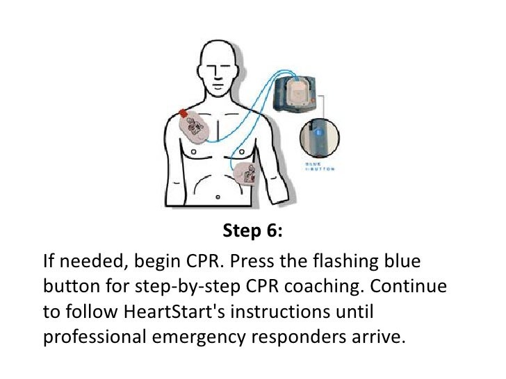 Post Defibrillation Care A Step By Step Guide For Lifesavers - kejgzuy