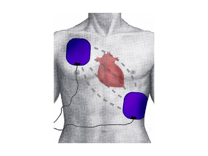 Portable Defibrillator With Step by Step Guide