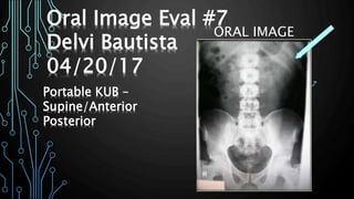 ORAL IMAGE
EVALUATION #5
SACRUM – LATERAL
PROJECTION
DELVI BAUTISTA – 4/11/2017
Oral Image Eval #7
Delvi Bautista
04/20/17
Portable KUB –
Supine/Anterior
Posterior
 