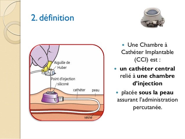 chambre implantable chimiotherapie